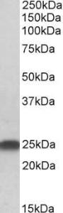 Anti-LIN7B Antibody (A83991) (0.5µg/ml) staining of Rat Brain lysate (35µg protein in RIPA buffer). Primary incubation was 1 hour. Detected by chemiluminescence.