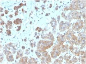 Immunohistochemical analysis of formalin-fixed, paraffin-embedded human adrenal gland tissue using Anti-IL-1 beta Antibody [IL1B/3993]