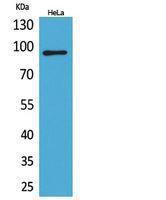 Western blot analysis of HeLa cells using Anti-ITGB2 Antibody