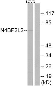 Western blot analysis of lysates from LOVO cells using Anti-N4BP2L2 Antibody. The right hand lane represents a negative control, where the Antibody is blocked by the immunising peptide