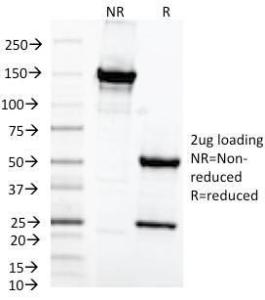 SDS-PAGE analysis of Anti-MAML2 Antibody [MAML2/1302] under non-reduced and reduced conditions; showing intact IgG and intact heavy and light chains, respectively. SDS-PAGE analysis confirms the integrity and purity of the antibody.