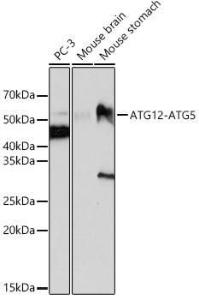 Western blot analysis of extracts of various cell lines, using Anti-ATG12 Antibody [ARC0089] (A305470) at 1:1,000 dilution. The secondary antibody was Goat Anti-Rabbit IgG H&L Antibody (HRP) at 1:10,000 dilution.