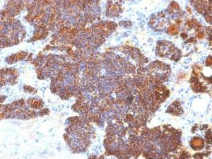 Immunohistochemical analysis of formalin-fixed, paraffin-embedded human parathyroid using Anti-Parathyroid Hormone Antibody [PTH/1173]