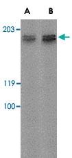 Anti-ADGRA2 Rabbit Polyclonal Antibody