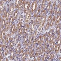 Anti-DDX51 Rabbit Polyclonal Antibody