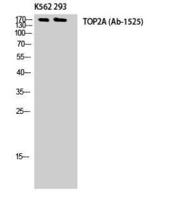 Western blot analysis of K562 293 cells using Anti-TOP2A Antibody