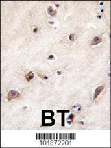 Anti-GDF1 Rabbit Polyclonal Antibody (Biotin)