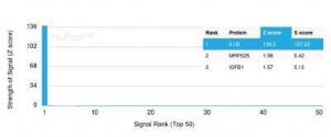 Analysis of protein array containing more than 19000 full-length human proteins using Anti-IL-1 beta Antibody [IL1B/3993].