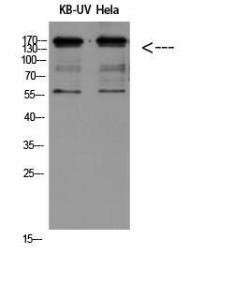 Western blot analysis of KB UV Hela using Anti-ITGB2 Antibody