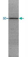 Anti-MMP2 Mouse Monoclonal Antibody [clone: 4D3]