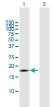 Anti-ID4 Mouse Polyclonal Antibody