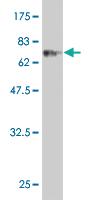 Anti-CLN3 Mouse Monoclonal Antibody [clone: 1G10]