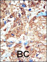 Anti-EPHB1 Rabbit Polyclonal Antibody (FITC (Fluorescein))