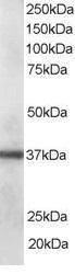 Anti-PDLIM1 Antibody (A83995) staining (0.1 µg/ml) of Human Lung lysate (RIPA buffer, 35 µg total protein per lane). Primary incubated for 1 hour. Detected by chemiluminescence