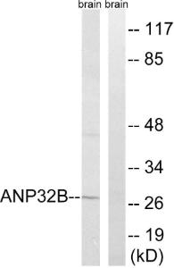 Western blot analysis of lysates from rat brain cells using Anti-ANP32B Antibody The right hand lane represents a negative control, where the antibody is blocked by the immunising peptide