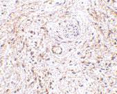 Anti-ADGRA2 Rabbit Polyclonal Antibody