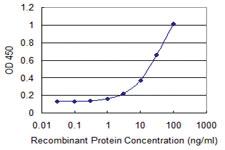 Anti-SGOL1 Mouse Monoclonal Antibody [clone: 4G6]