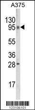 Anti-BROMI Rabbit Polyclonal Antibody (HRP (Horseradish Peroxidase))