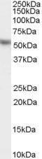 Anti-KPNA2 Antibody (A83997) staining (0.03µg/ml) of Hela lysate (RIPA buffer, 35µg total protein per lane). Primary incubated for 1 hour. Detected by chemiluminescence.