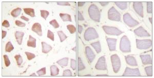 Immunohistochemical analysis of paraffin-embedded human skeletal muscle tissue using Anti-TNNI3 Antibody. The right hand panel represents a negative control, where the Antibody was pre-incubated with the immunising peptide