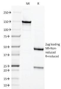 SDS-PAGE analysis of Anti-Chromogranin A Antibody [LK2H10] under non-reduced and reduced conditions; showing intact IgG and intact heavy and light chains, respectively. SDS-PAGE analysis confirms the integrity and purity of the antibody