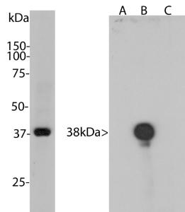 Antibody anti-AURORA B kinase 3F11 100 µl