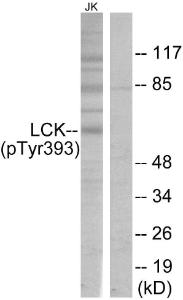 Anti-Lck Rabbit Polyclonal Antibody