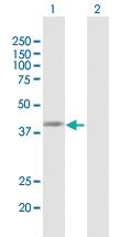 Anti-IDH1 Rabbit Polyclonal Antibody