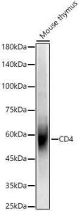 Western blot analysis of Mouse thymus, using Anti-CD4 Antibody (A309315) at 1:500 dilution. The secondary Antibody was Goat Anti-Rabbit IgG H&L Antibody (HRP) at 1:10000 dilution. Lysates/proteins were present at 25 µg per lane