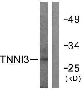 Western blot analysis of lysates from mouse heart cells using Anti-TNNI3 Antibody. The right hand lane represents a negative control, where the Antibody is blocked by the immunising peptide