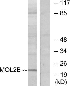 Anti-MOBKL2B Rabbit Polyclonal Antibody