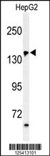 Anti-PUR4 Rabbit Polyclonal Antibody