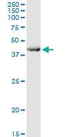 Anti-IDH1 Rabbit Polyclonal Antibody