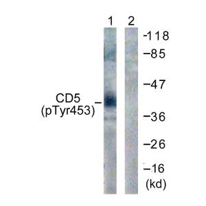 Western blot analysis of lysates from 293 cells treated with PMA 125 ng/ml 30' using Anti-CD5 (phospho Tyr453) Antibody. The right hand lane represents a negative control, where the antibody is blocked by the immunising peptide