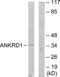 Anti-ANKRD1 Rabbit Polyclonal Antibody