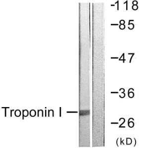 Western blot analysis of lysates from Jurkat cells using Anti-TNNI3 Antibody. The right hand lane represents a negative control, where the antibody is blocked by the immunising peptide.