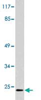 Anti-DNPH1 Rabbit Polyclonal Antibody