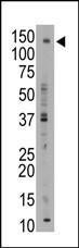 Anti-ABCB11 Rabbit Polyclonal Antibody (FITC (Fluorescein))