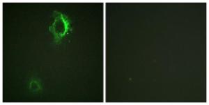 Immunofluorescence analysis of HepG2 cells using Anti-CD5 (phospho Tyr453) Antibody. The right hand panel represents a negative control, where the antibody was pre-incubated with the immunising peptide