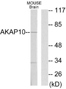 Western blot analysis of lysates from mouse brain using Anti-AKAP10 Antibody. The right hand lane represents a negative control, where the antibody is blocked by the immunising peptide