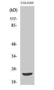 Anti-MOBKL2B Rabbit Polyclonal Antibody