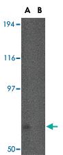 Anti-FNBP1L Rabbit Polyclonal Antibody