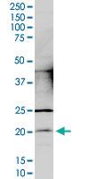 Anti-CCDC12 Mouse Monoclonal Antibody [clone: 7B1]