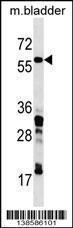 Anti-CORO1C Rabbit Polyclonal Antibody (HRP (Horseradish Peroxidase))