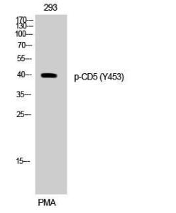 Western blot analysis of 293 cells using Anti-CD5 (phospho Tyr453) Antibody