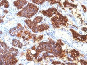 Immunohistochemical analysis of formalin-fixed, paraffin-embedded human parathyroid gland using Anti-Parathyroid Hormone Antibody [PTH/1175]