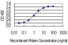 Anti-CCDC12 Mouse Monoclonal Antibody [clone: 7B1]