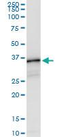 Anti-HLA-DQB1 Polyclonal Antibody Pair