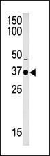 Anti-SETD7 Rabbit Polyclonal Antibody (HRP (Horseradish Peroxidase))