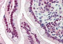 Anti-KPNA4 Antibody (A84001) (5µg/ml) staining of paraffin embedded Human Small Intestine. Steamed antigen retrieval with citrate buffer pH 6, AP-staining.